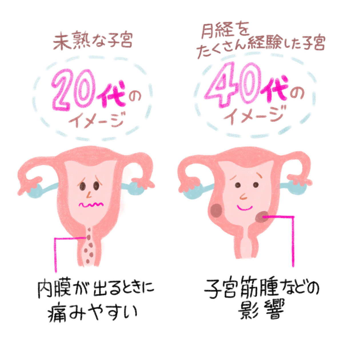 10~20代の子宮は未成熟で生理不順がおきやすく生理痛が重くなる原因に。一方、40代の生理痛の重さは子宮筋腫などの影響の可能性